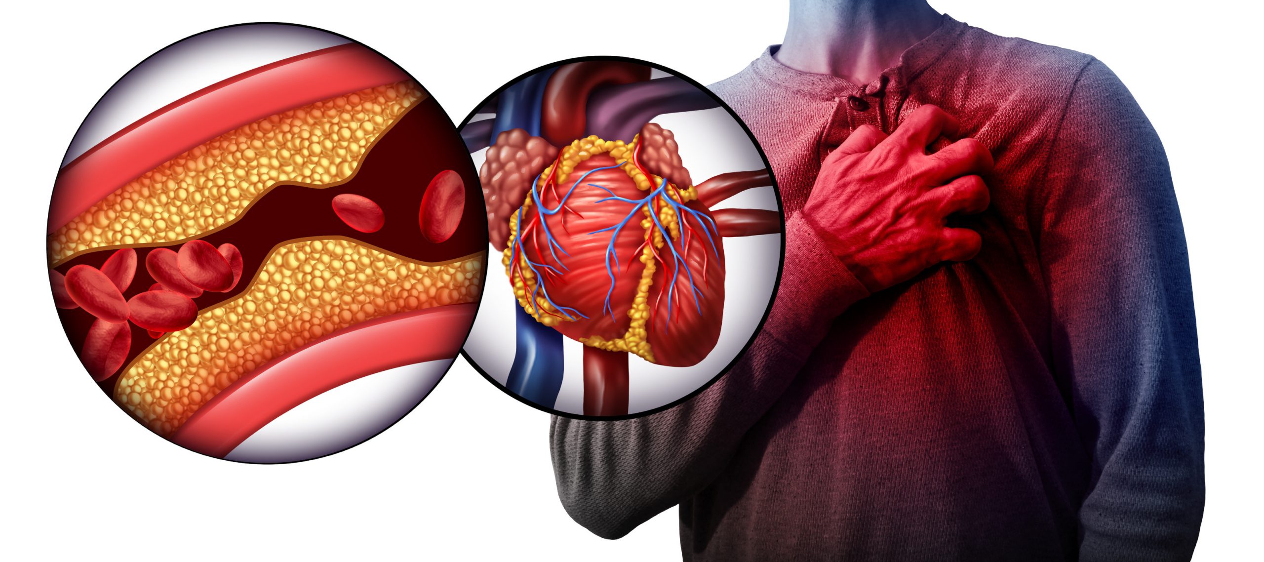 Nadciśnienie tętnicze, przyczyny i objawy. Jak żyć z nadciśnieniem?