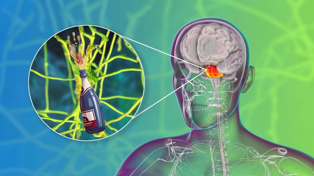 mielinoliza srodkowa mostu